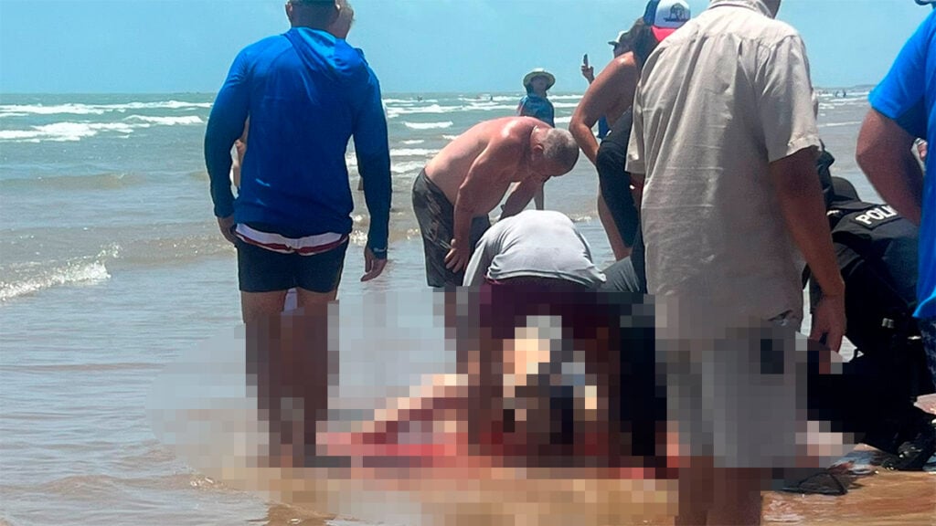 Texas: Dos turistas sufrieron un ataque de tiburón en Isla del Padre