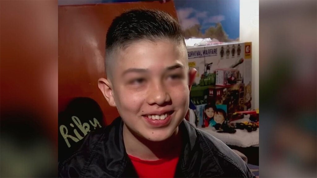 Colombia: Un menor sufre picadura de araña violinista 