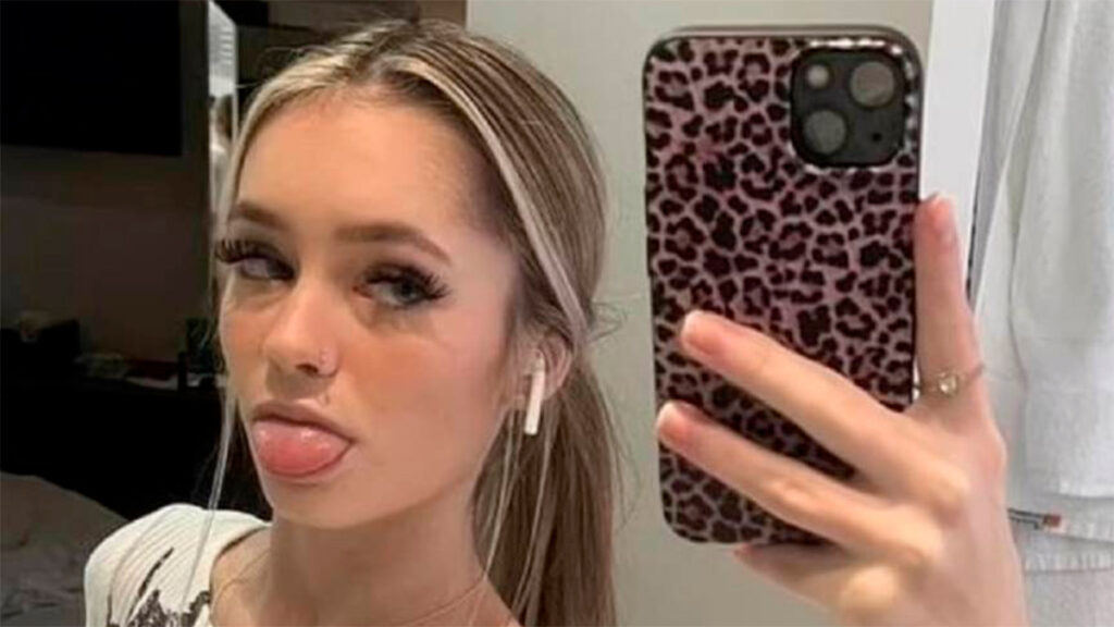 Reino Unido: Joven adquiere rara enfermedad por compartir su vapeador