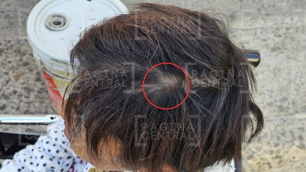 Mujer herida por Guardia Nacional dice que elementos huyeron