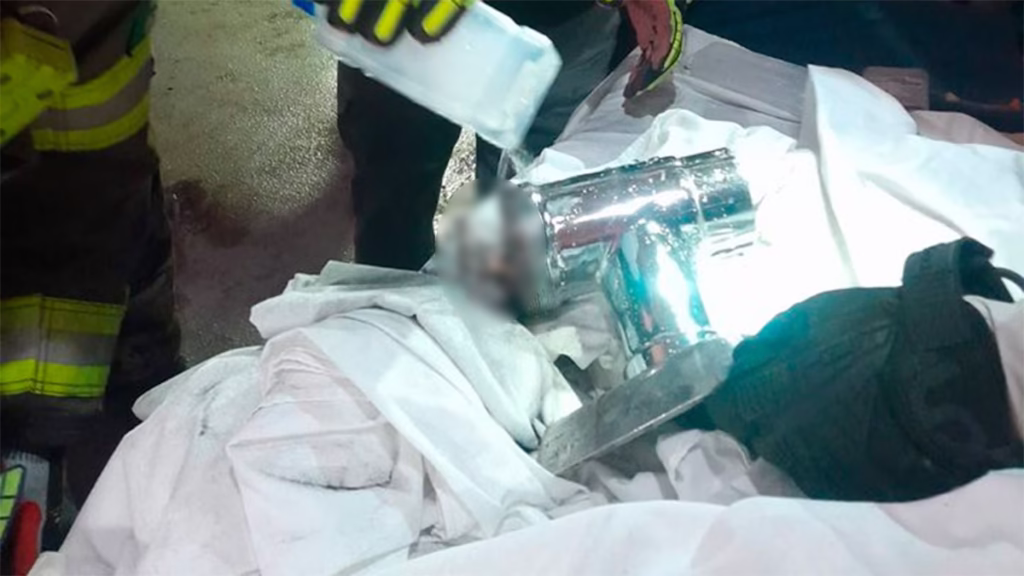 Nuevo León: Bebé pierde la mano izquierda en una máquina moledora de carne